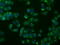 Microseminoprotein Beta antibody, GTX84083, GeneTex, Immunofluorescence image 