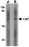 Leucine-rich repeat LGI family member 2 antibody, A13256-1, Boster Biological Technology, Western Blot image 