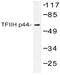 General Transcription Factor IIH Subunit 2 antibody, AP20441PU-N, Origene, Western Blot image 