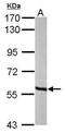 Methylcrotonoyl-CoA Carboxylase 2 antibody, GTX102674, GeneTex, Western Blot image 