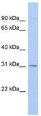 Tetraspanin 12 antibody, TA341908, Origene, Western Blot image 