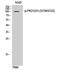 Protein Kinase D1 antibody, STJ90866, St John