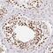 Serine And Arginine Rich Splicing Factor 10 antibody, NBP2-46818, Novus Biologicals, Immunohistochemistry paraffin image 