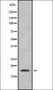 Phospholipase A And Acyltransferase 4 antibody, orb338650, Biorbyt, Western Blot image 