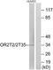 Olfactory Receptor Family 2 Subfamily T Member 2 antibody, A30871, Boster Biological Technology, Western Blot image 