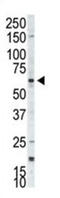 Ribosomal Protein S6 Kinase B2 antibody, abx033814, Abbexa, Western Blot image 