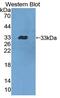 Dystrobrevin Beta antibody, abx130457, Abbexa, Western Blot image 