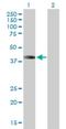 Homeobox A1 antibody, H00003198-B01P, Novus Biologicals, Western Blot image 