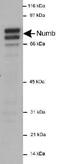 NUMB Endocytic Adaptor Protein antibody, PA1-32452, Invitrogen Antibodies, Western Blot image 