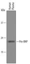 Natriuretic Peptide B antibody, AF3604, R&D Systems, Western Blot image 