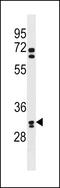 Olfactory Receptor Family 6 Subfamily B Member 2 antibody, 60-447, ProSci, Western Blot image 