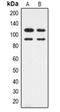 Cyclin Dependent Kinase 11B antibody, orb318771, Biorbyt, Western Blot image 