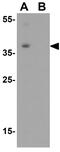 SUMO1 Activating Enzyme Subunit 1 antibody, GTX31803, GeneTex, Western Blot image 