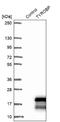 TYRO Protein Tyrosine Kinase Binding Protein antibody, NBP1-85313, Novus Biologicals, Western Blot image 