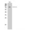 Cortactin antibody, LS-C382867, Lifespan Biosciences, Western Blot image 