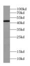 Retinoid X Receptor Alpha antibody, FNab07543, FineTest, Western Blot image 