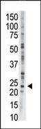 Adenylate Kinase 1 antibody, 63-438, ProSci, Western Blot image 