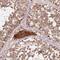 Pyruvate Dehydrogenase E1 Alpha 1 Subunit antibody, NBP2-54747, Novus Biologicals, Immunohistochemistry paraffin image 