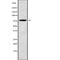 Acyl-CoA Oxidase 3, Pristanoyl antibody, abx147933, Abbexa, Western Blot image 