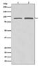 SUZ12 Polycomb Repressive Complex 2 Subunit antibody, M00583, Boster Biological Technology, Western Blot image 