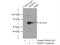 Matrix Metallopeptidase 19 antibody, 14244-1-AP, Proteintech Group, Immunoprecipitation image 