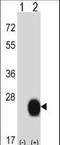 Cysteine And Glycine Rich Protein 2 antibody, LS-C167097, Lifespan Biosciences, Western Blot image 