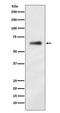 Heterogeneous Nuclear Ribonucleoprotein K antibody, M01793, Boster Biological Technology, Western Blot image 