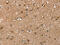 RAB9A, Member RAS Oncogene Family antibody, CSB-PA994941, Cusabio, Immunohistochemistry paraffin image 