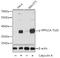 Protein Phosphatase 1 Catalytic Subunit Alpha antibody, LS-C750593, Lifespan Biosciences, Western Blot image 