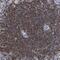 Hematopoietic Cell-Specific Lyn Substrate 1 antibody, NBP1-85380, Novus Biologicals, Immunohistochemistry paraffin image 