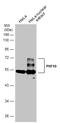 PHD Finger Protein 10 antibody, GTX116314, GeneTex, Western Blot image 