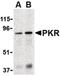 Eukaryotic Translation Initiation Factor 2 Alpha Kinase 2 antibody, PA5-20284, Invitrogen Antibodies, Western Blot image 