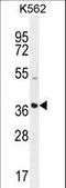 Secreted Frizzled Related Protein 4 antibody, LS-C169015, Lifespan Biosciences, Western Blot image 
