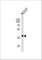 Transcription factor SOX-2 antibody, M00105-3, Boster Biological Technology, Western Blot image 