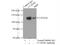 Coiled-Coil And C2 Domain Containing 1B antibody, 20774-1-AP, Proteintech Group, Immunoprecipitation image 