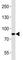 Insulin Receptor antibody, F52829-0.4ML, NSJ Bioreagents, Western Blot image 