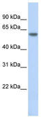 Thyroid Hormone Receptor Beta antibody, TA335177, Origene, Western Blot image 