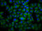 Dysferlin antibody, LS-C673588, Lifespan Biosciences, Immunofluorescence image 