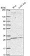 Pleckstrin Homology Domain Containing B2 antibody, HPA075014, Atlas Antibodies, Western Blot image 