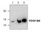 Platelet Derived Growth Factor Subunit B antibody, GTX59866, GeneTex, Western Blot image 