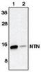 Neurturin antibody, MBS395487, MyBioSource, Western Blot image 