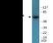 SHC Adaptor Protein 1 antibody, EKC1954, Boster Biological Technology, Western Blot image 