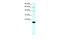 Claudin 23 antibody, ARP33633_P050, Aviva Systems Biology, Western Blot image 