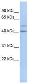 Spermatogenesis And Centriole Associated 1 antibody, TA333348, Origene, Western Blot image 