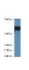 Fibrinogen Beta Chain antibody, LS-C294154, Lifespan Biosciences, Western Blot image 