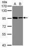 DExD-Box Helicase 21 antibody, GTX115199, GeneTex, Western Blot image 