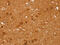 Cyclin D2 antibody, CSB-PA098232, Cusabio, Immunohistochemistry frozen image 