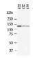 Matrin 3 antibody, LS-C72171, Lifespan Biosciences, Western Blot image 