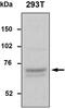 Tyrosyl-DNA Phosphodiesterase 1 antibody, PA5-27111, Invitrogen Antibodies, Western Blot image 