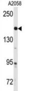 ABL Proto-Oncogene 1, Non-Receptor Tyrosine Kinase antibody, abx031824, Abbexa, Western Blot image 